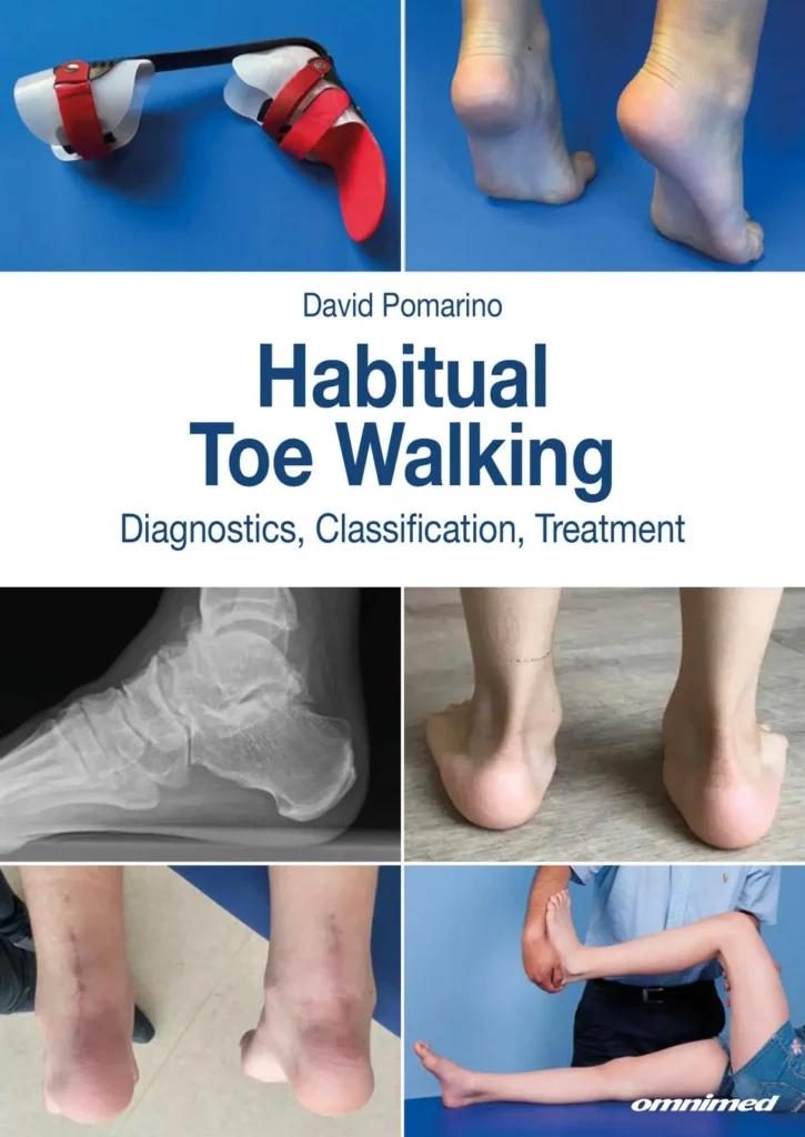 David Pomarino Habitual Toe Walking Diagnostics, Classification, Treatment
